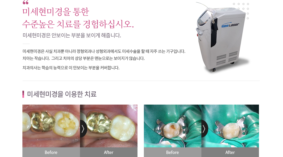 미세현미경 및 레이저 내용
