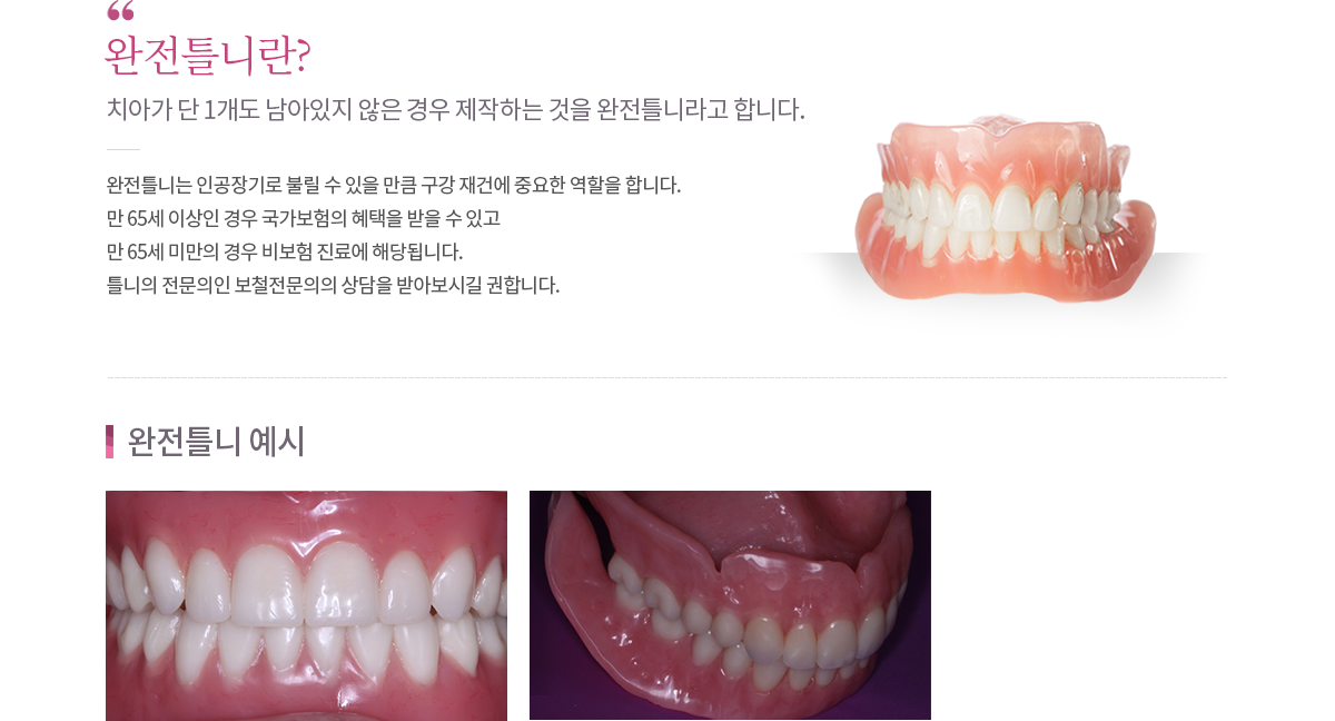완전틀니 내용
