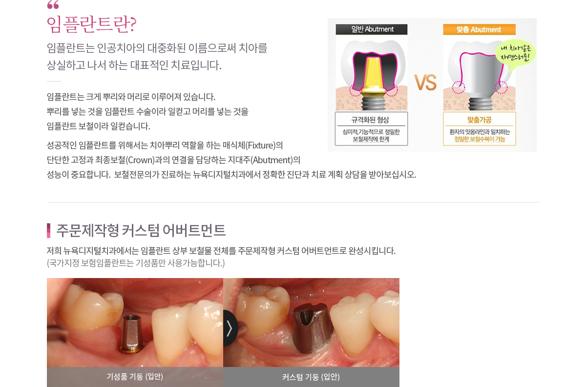 임플란트 내용